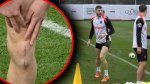 Mihai Popescu, recuperare record dup? accidentarea horror. A inceput antrenamentele cu FCSB in Antalya. Foto ?i video