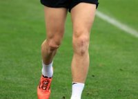 Revenire miraculoas? la antrenamentele lui FCSB! Cum arat? genunchiul lui Mihai Popescu, dup? accidentarea grav? ?i&nbsp;(…)