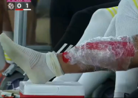 Florinel Coman s-a accidentat in duelul cu echipa lui Cosmin Contra » Exces de zel al arbitrului