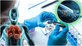 Microplasticele din corpul uman: realitate ?tiin?ific? sau interpretare gre?it? a rezultatelor? Avertismentul&nbsp;(…)