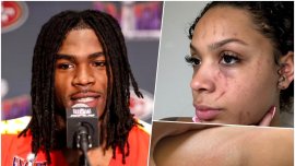 Sportivul celebru care a fost acuzat de violen?? domestic?! Fosta iubit? a publicat imagini cu vân?t?ile ?i r?nile&nbsp;(…)